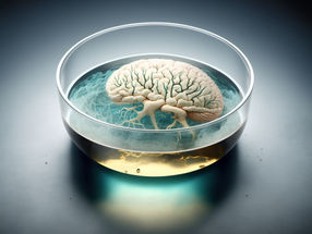 Healing the brain: Hydrogels enable neuronal tissue growth