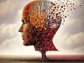 De nouvelles perspectives sur le développement de la maladie d'Alzheimer