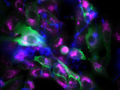 Fungal spores hijack lung cells
