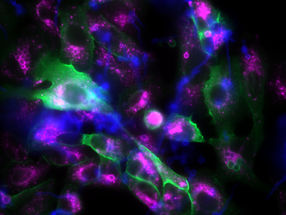 Les spores fongiques détournent les cellules pulmonaires