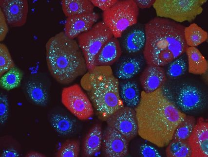 Descubierto un nuevo "detector de humo" intracelular
