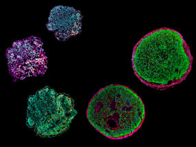 Un minicorazón en una placa de Petri: el organoide emula el desarrollo del corazón humano