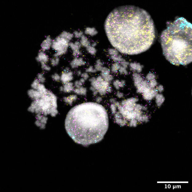 Wie sich Krebsgene selbständig machen - Studie wirft Licht auf die mysteriöse Evolution von DNA-Ringen