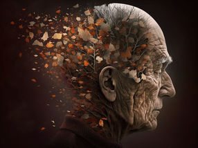 Alzheimer: Modulation der Zellmembran beeinflusst Bildung von Amyloid-β