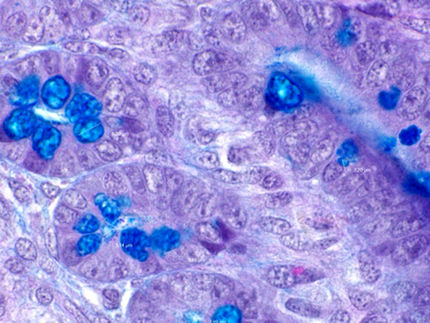 Coupe transversale de l'intestin d'un poulet avec des cellules susceptibles d'être affectées par les nanoparticules alimentaires.