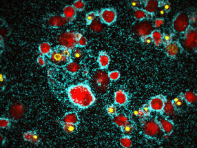 La bactérie du choléra forme un biofilm agressif pour tuer les cellules immunitaires