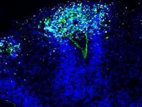 L'étude de l'encéphalite herpétique à l'aide de mini-cerveaux