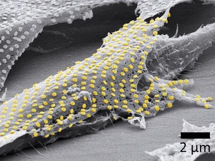 Tattoo-Technik überträgt Gold-Nanomuster auf lebende Zellen