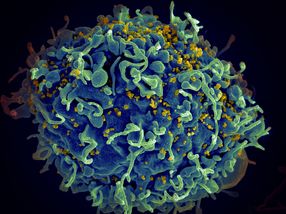Des chercheurs découvrent une nouvelle voie d'invasion du noyau cellulaire par le VIH