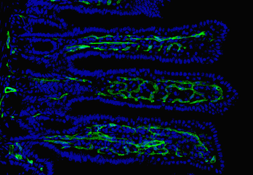 © Universitätsmedizin Mainz / Christoph Reinhardt