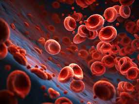 Störungen im Fettstoffwechsel beeinflussen die Produktion von Blutplättchen