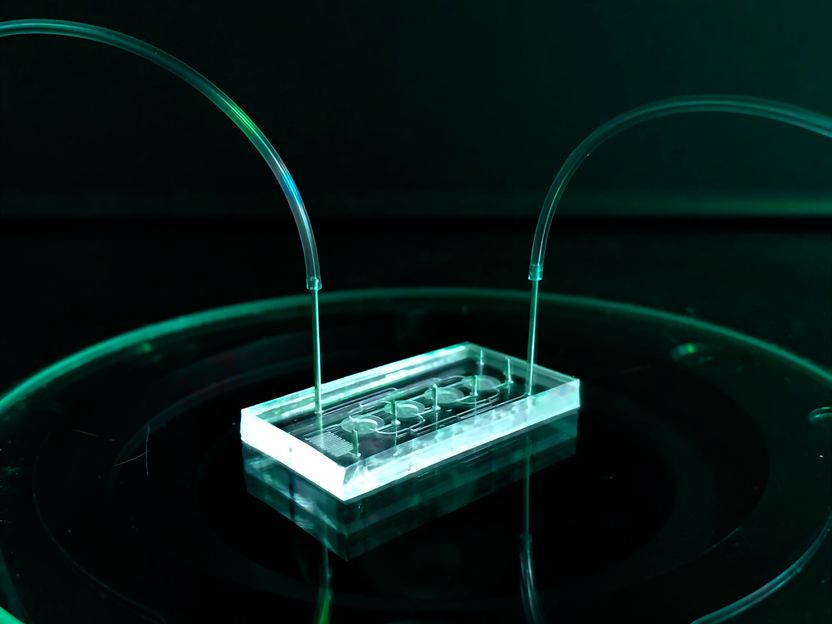 Weiblicher Resilienz auf der Spur - Organ-on-Chip-Technologie soll Einblicke in den Einfluss der Menopause auf immunologische und metabolische Resilienz ermöglichen