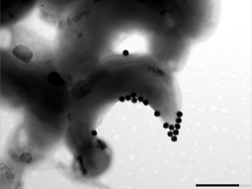 Assessing the toxicity of micro- and nanoplastics to ecosystems - Smaller is not necessarily less toxic