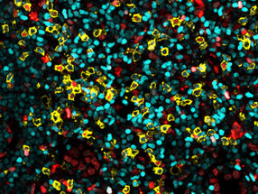 Células T residentes descubiertas en los ganglios linfáticos