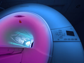 Nueva herramienta de IA para el diagnóstico de tumores cerebrales