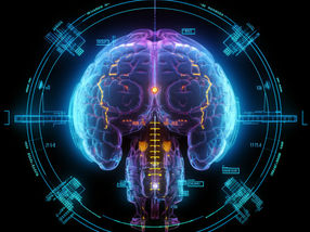Innovation en médecine nucléaire : les signaux PET dans les tumeurs cérébrales décodés pour la première fois au niveau cellulaire