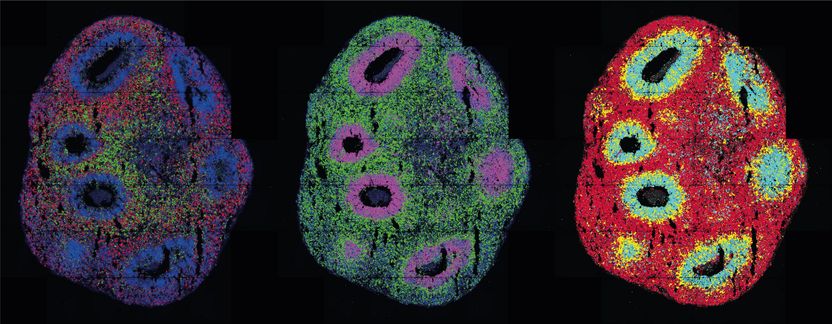 Design organoids with light - Organoids help researchers understand biological processes in health and disease