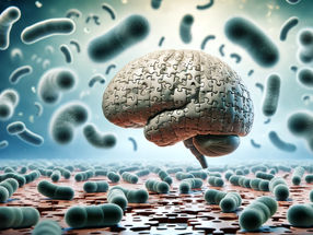 La infección por bacterias estomacales puede aumentar el riesgo de Alzheimer