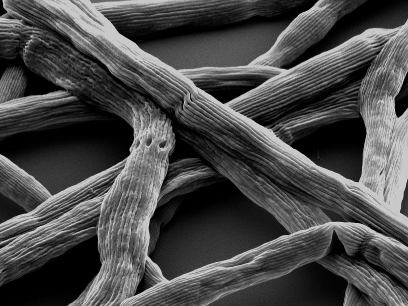 Mikrobe des Jahres 2024: Kabelbakterium Electronema - Lebender Stromleiter - Kabelbakterien reduzieren Schadstoffe und Treibhausgase