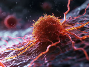 Umprogrammierte Fettzellen unterstützen das Tumorwachstum