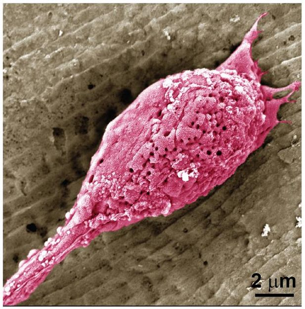 Adapted from ACS Biomaterials Science & Engineering 2024, DOI: 10.1021/acsbiomaterials.3c01500