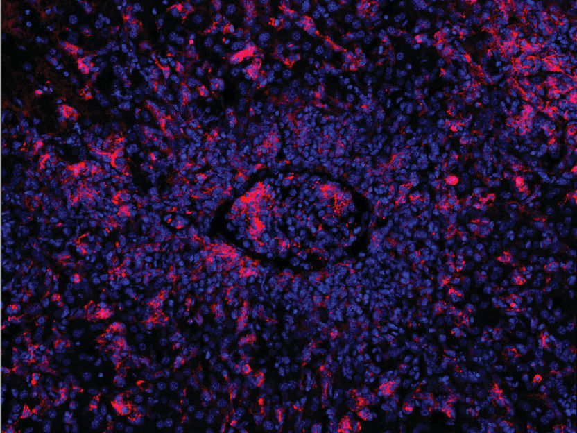 Genschere repariert defekte Immunzellen - Mithilfe CRISPR-Cas9 lassen sich erbliche Gendefekte reparieren, die zu einer überschießenden Immunantwort führen, die tödlich enden kann