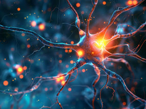Alzheimer-Proteine zur Früherkennung der Krankheit zum Leuchten bringen