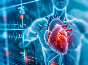 Un análisis de sangre normal puede predecir un infarto