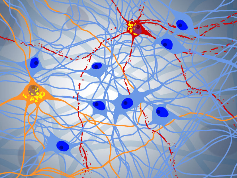 Mögliches Zielprotein für die Behandlung von neurodegenerativen Erkrankungen entdeckt - Neuartiges neuronales Zellkulturmodell entwickelt