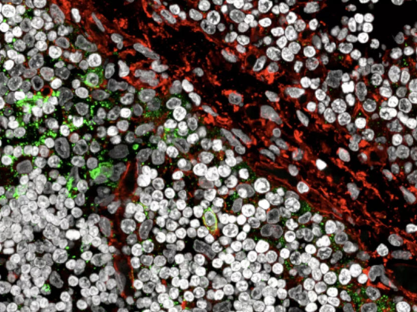 Possible trigger for autoimmune diseases discovered - B cells teach T cells which targets must not be attacked