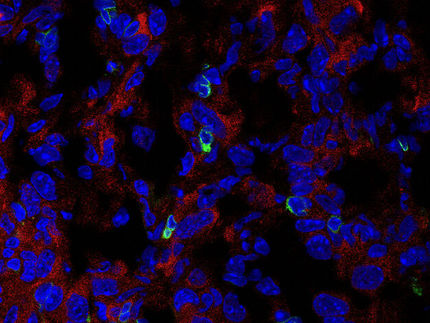 Immune system meets cancer: Checkpoint identified to fight solid tumors