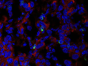 Immune system meets cancer: Checkpoint identified to fight solid tumors