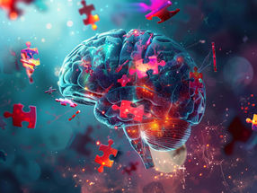 PharmaKure anuncia una colaboración con la Universidad Sheffield Hallam para comprender los mecanismos de la enfermedad de Alzheimer