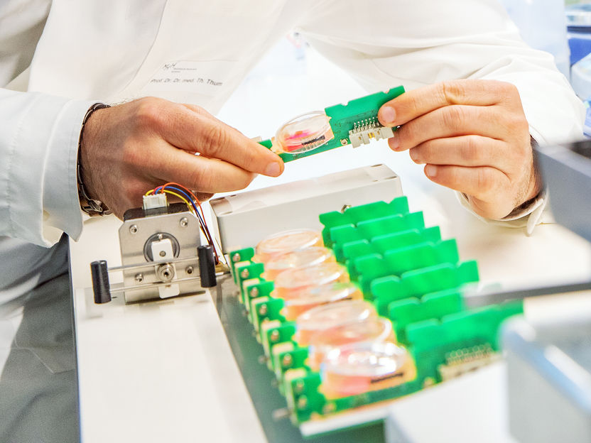 Des tranches de muscle cardiaque vivant stimulent la recherche sur l'insuffisance cardiaque par l'ARN - Les chercheurs placent du tissu cardiaque humain vivant dans une solution nutritive et l'utilisent pour tester de nouveaux médicaments et des approches innovantes pour lutter contre l'insuffisance cardiaque