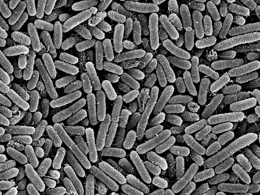 New starting point discovered in the fight against Pseudomonas aeruginosa - Research team shows how an enzyme regulates the pathogenicity of a clinically relevant pathogen