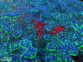 Un modèle de puce intestinale permet de franchir une nouvelle étape dans la recherche sur les infections fongiques