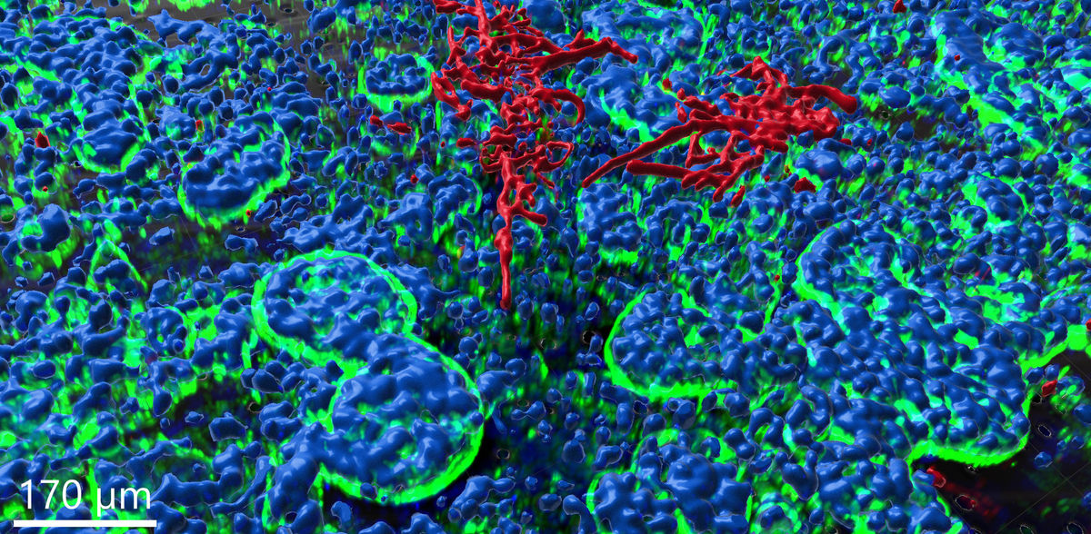 Mit einem neuen 3D-Darm-Chip-Modell erreicht die Erforschung von Pilzinfektionen eine neue Qualität