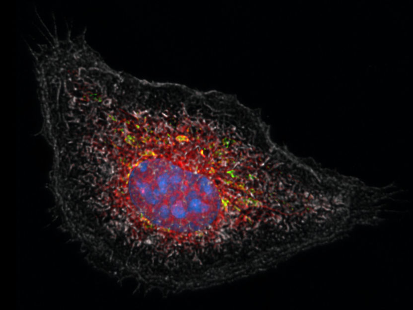 How the body switches out of “fight” mode - Study unlocks how cortisone inhibits inflammation