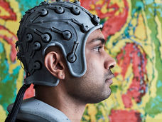 Innovative treatment helmet from a Basel spin-off promises advances in the treatment of Alzheimer’s