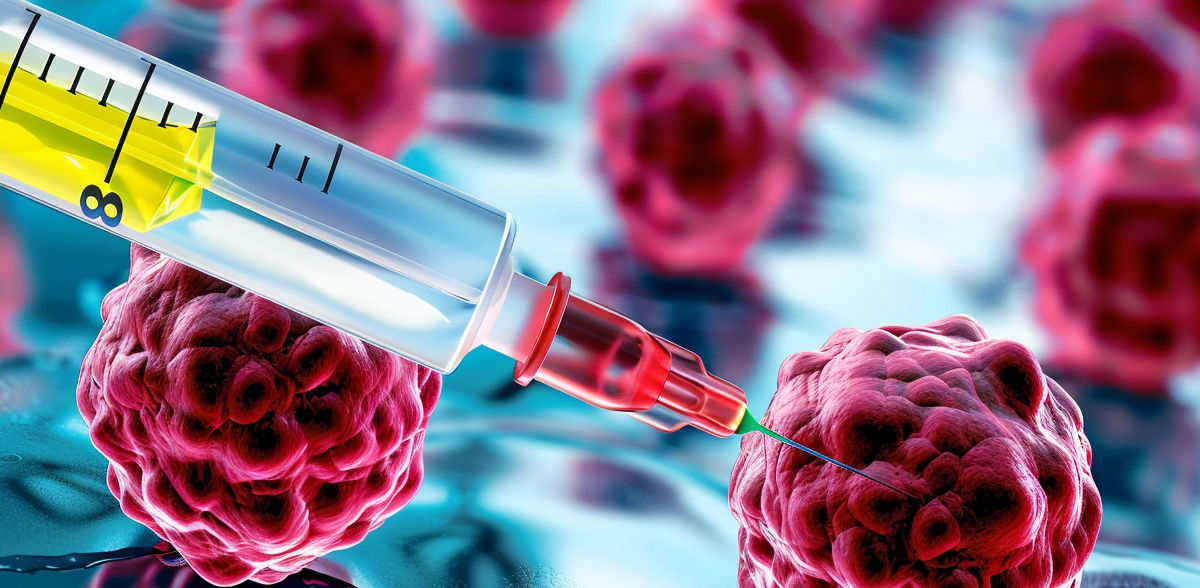 CureVac und MD Anderson gehen strategische Kooperation zur Entwicklung neuartiger Krebsimpfstoffe ein