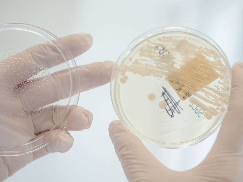 Eine zweite Chance für einen neuen antibiotischen Wirkstoff - Vor 20 Jahren verworfener Wirkstoffkandidat dank neuer Forschung nun möglicherweise selektiver