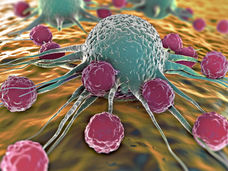 Cómo reconocen las células inmunitarias el metabolismo anormal de las células cancerosas