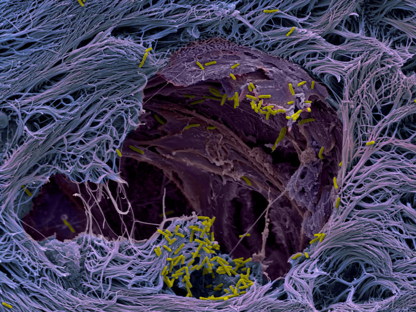 Lung organoids unveil secret: How pathogens infect human lung tissue - New sensor for monitoring bacteria