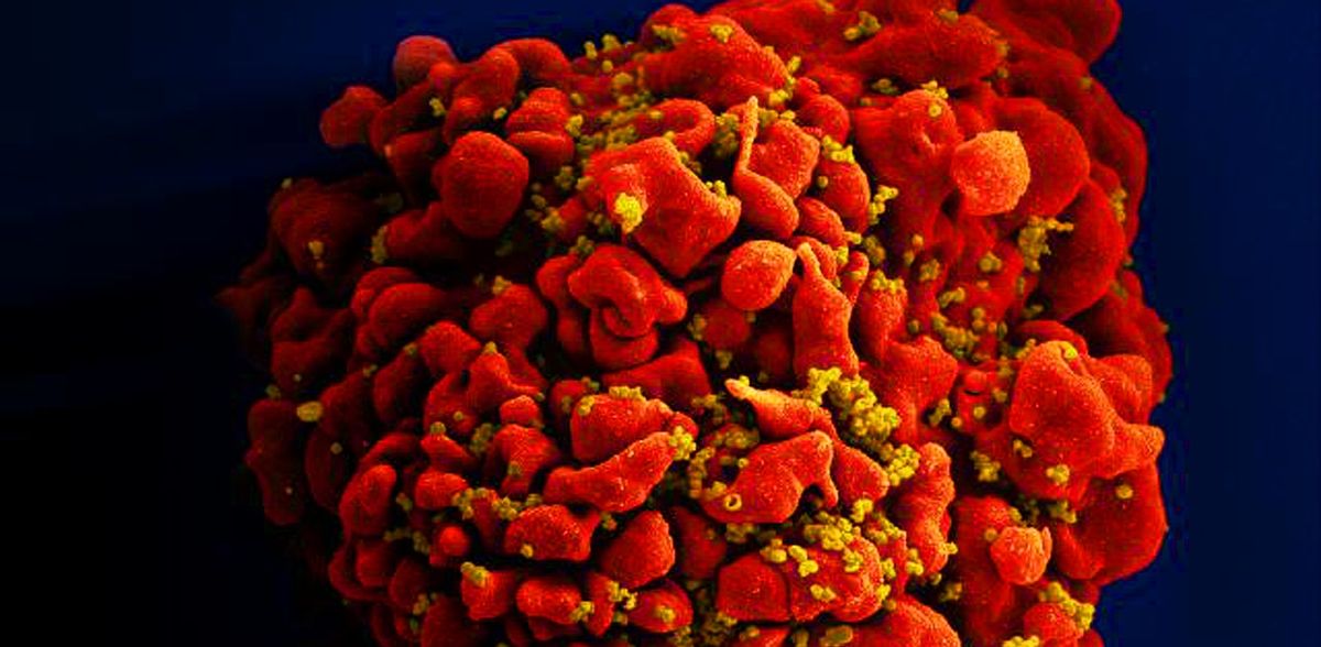 HIV cured at Charité: the next Berlin patient