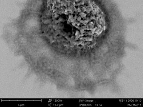 Sans son hôte : la transmission de la tuberculose ne dépend pas seulement de l'agent pathogène