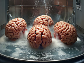 Neurobiology: Washing machine for the brain