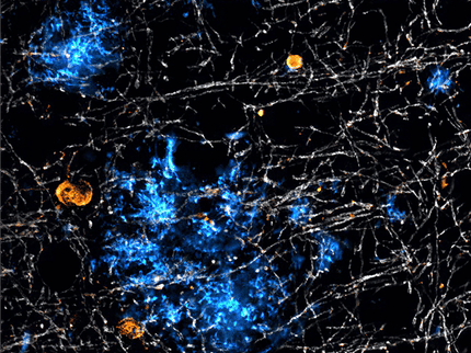 Alzheimer’s disease: It’s not only neurons – glial cells also produce harmful proteins