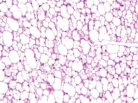 Die beigen Fettzellen mit dem Sisyphos-Mechanismus