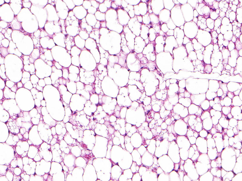 Células de grasa beige con un "mecanismo de Sísifo" - Una nueva clase de células adiposas hace más sanas a las personas: las células consumen energía y producen calor mediante reacciones bioquímicas aparentemente inútiles.