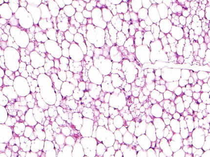 Beige fat cells with a “Sisyphus mechanism”